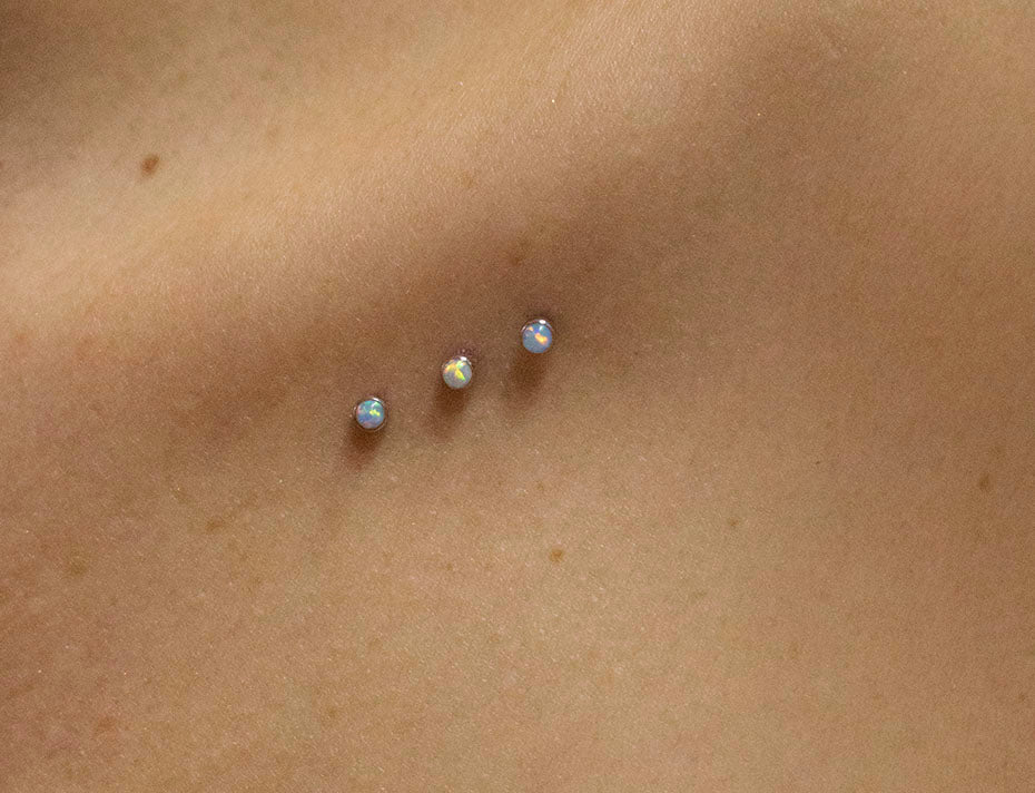 Microdermal