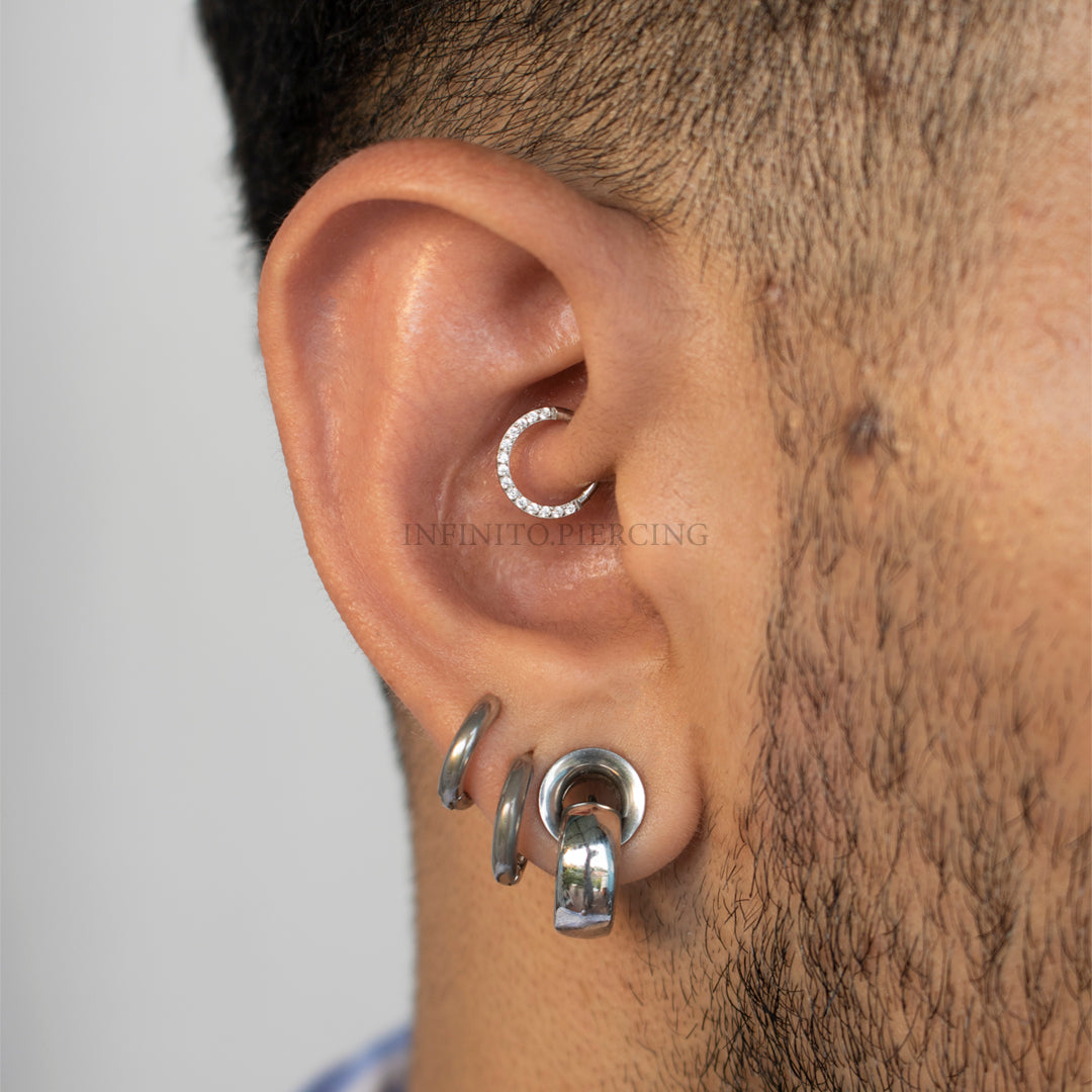ARO CLICKER ZIRCONIAS FRONTALES ACERO